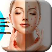 Face Blemish Remover 1.1