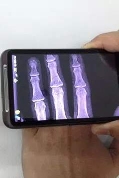 Xray Scanner screenshot 1