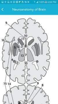 Neurology Essentials screenshot 7