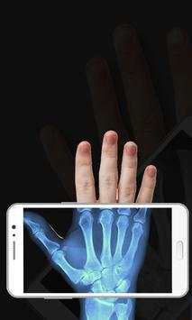 Body Scanner New Xray Real Cloth Camera Prank App screenshot 1