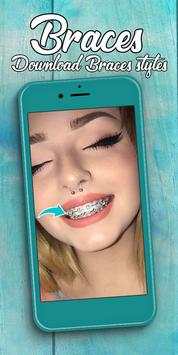 Braces screenshot 2