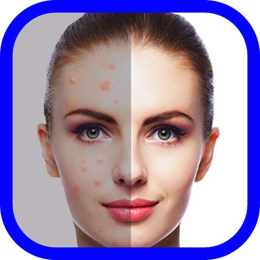 Face Blemish Eraser makeup 1.6
