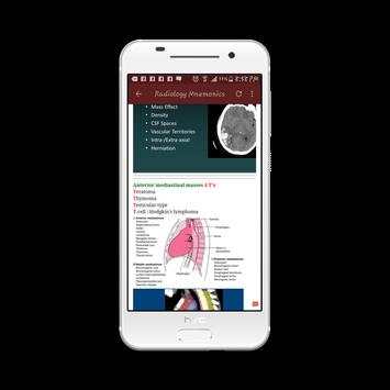 Radiology Mnemonics screenshot 7