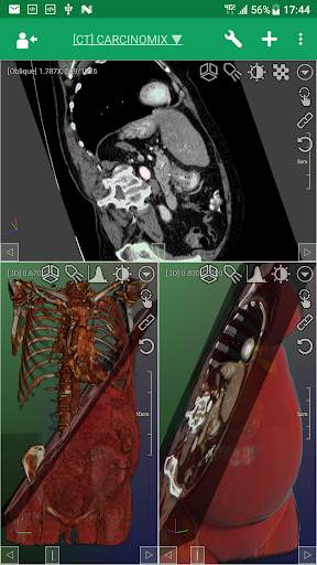 DroidRender - 3D DICOM viewer स्क्रीनशॉट 5