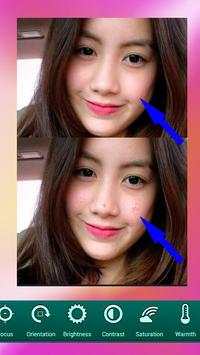 BesTie Camera Selfie Edit screenshot 3