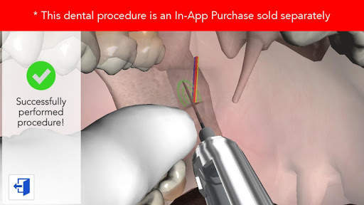 Dental Simulator screenshot 5