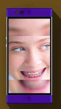 Real Braces Booth HD Studio screenshot 2