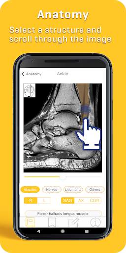 MRI Essentials screenshot 6
