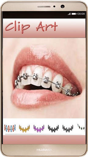 Braces Photo Editor - Braces For Your Teeth screenshot 1