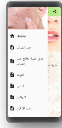حب الشباب وعلاجه 2 تصوير الشاشة