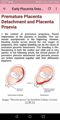 Human Embryology screenshot 6