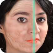 ikon Age Scanner