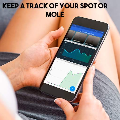 DermIA - Analyze Skin Cancer with your camera A.I screenshot 3
