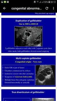 abdominal ultrasound of gallbladder скриншот 7