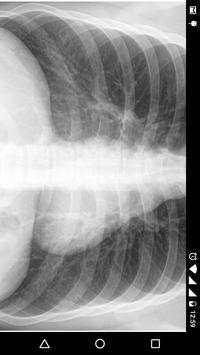 X - Ray Scanner Prank screenshot 6