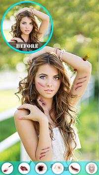 Injury Photo Editor скриншот 13