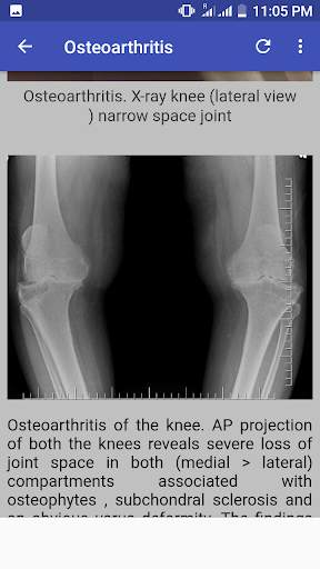 Bone X Ray Interpretation (Musculoskeletal X ray) screenshot 1