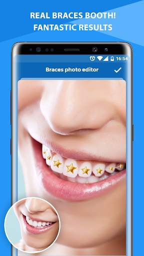 Braces Photo Editor screenshot 4