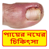 নখের কোনা ওঠা চিকিৎসা ~ Nail Treatment आइकन