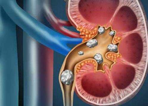 Kidney diseases screenshot 1