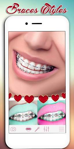 Braces Photo Editor screenshot 1