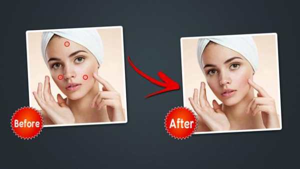 Object Remover -Erase Object -Face Blemish Remover screenshot 2