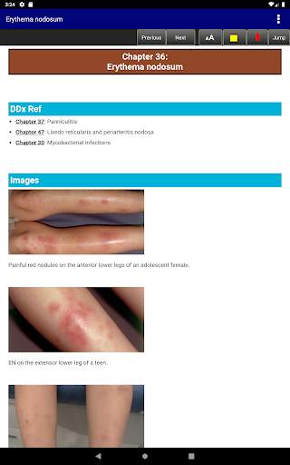 Pediatric Dermatology DDx Deck, 2nd Edition screenshot 20