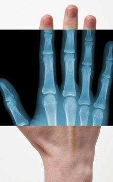 Xray Scanner screenshot 1