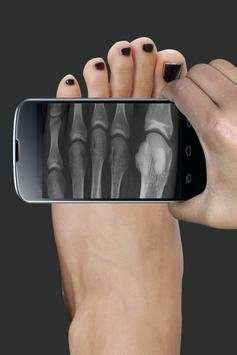 Real X Ray Body Scanner Prank: X Ray App screenshot 4