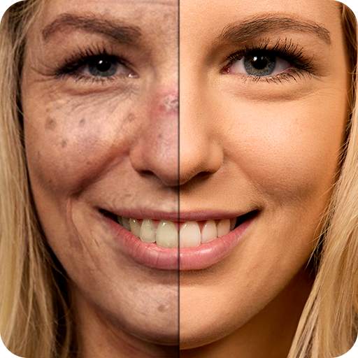 Sunface - UV-Selfie 1.0.4