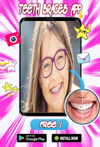 Braces Teeth  Photo Editor screenshot 3