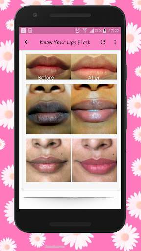 How To Get Soft Pink Lips Naturally - Lip Care screenshot 2