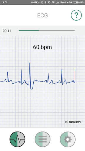 ECG mob screenshot 3