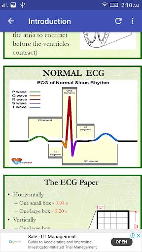 A to Z ECG Interpretation screenshot 2