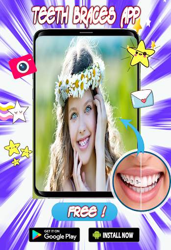 Braces Teeth  Photo Editor screenshot 2
