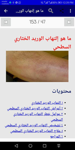 أمراض الباطنة 9 تصوير الشاشة