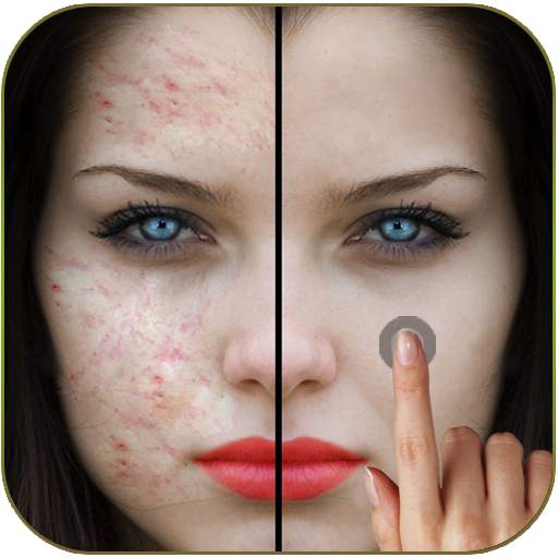 Pimples removing photo editing 1.0