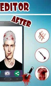 Fake Injuries Photo Editor 2019-Injury Marks Maker screenshot 3