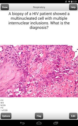 USMLE Step 2 CK Cards Lite screenshot 2