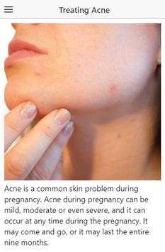 Treating Acne during Pregnancy screenshot 1