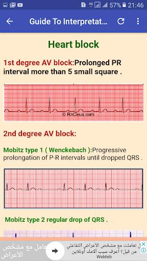 ECG Interpretation Made Easy скриншот 4