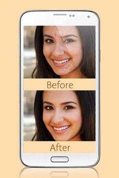 Photo Editor Blemish screenshot 5
