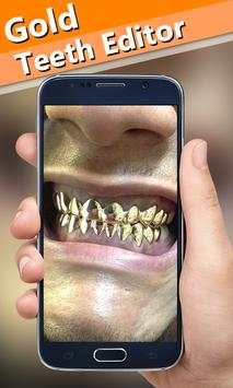 Gold Teeth Photo Editor screenshot 3