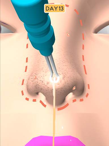 Nose Clean screenshot 11
