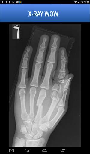 X-RAY WOW screenshot 14