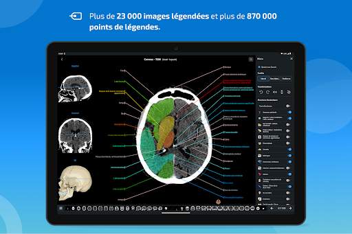 e-Anatomy screenshot 10