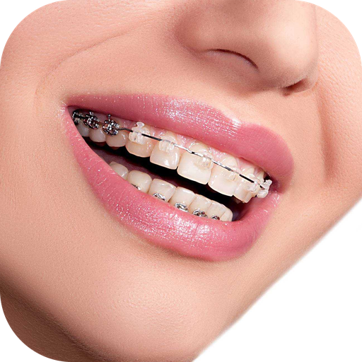 Real Braces Camera icon