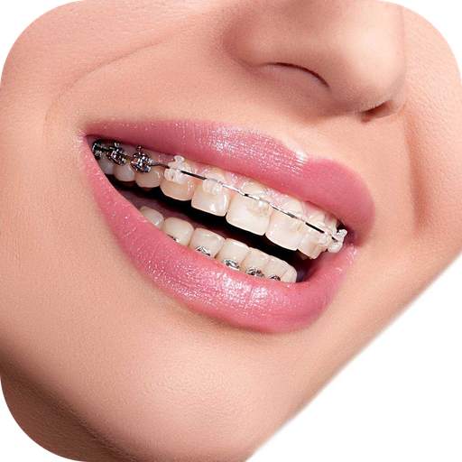 Real Braces Camera 2.1.10