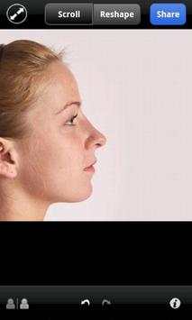 Plastic Surgery w/ Dr. Vitenas screenshot 4