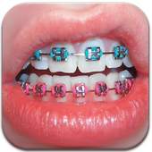 Real Braces Booth HD Studio 1.2